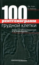 100 рентгенограмм грудной клетки