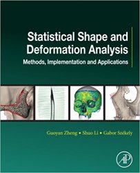 Statistical Shape and Deformation Analysis: Methods, Implementation and Applications