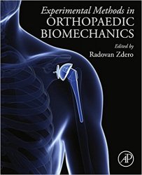 Experimental Methods in Orthopaedic Biomechanics