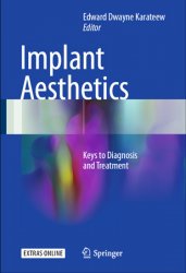 Implant Aesthetics: Keys to Diagnosis and Treatment